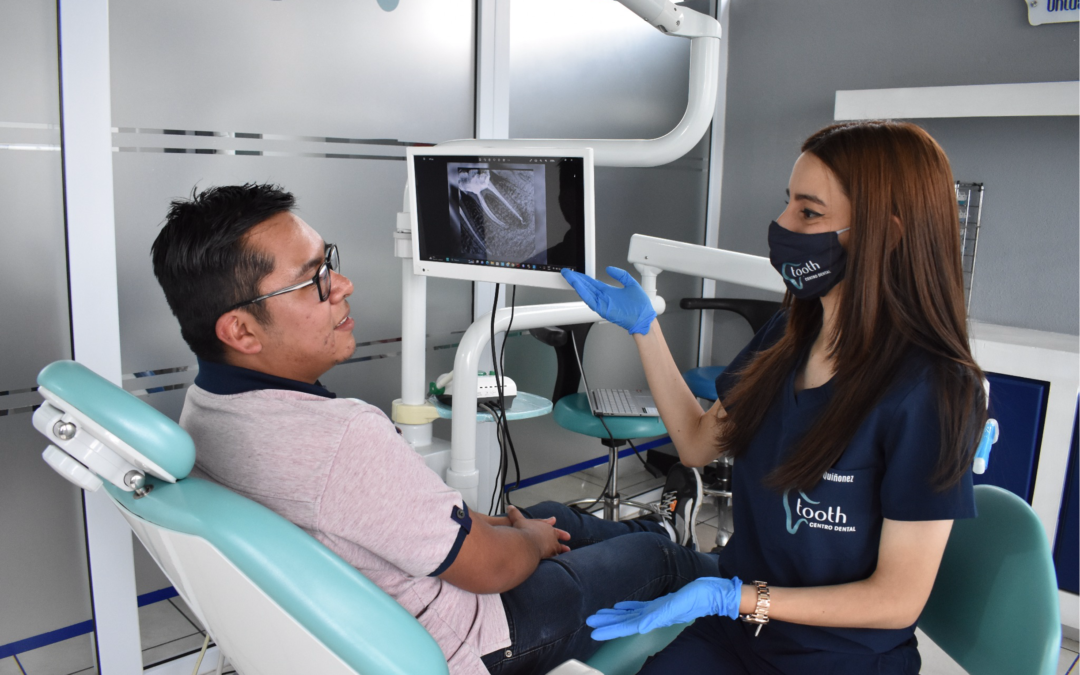 ¿CUÁNDO ES NECESARIO REALIZAR UNA ENDODONCIA?